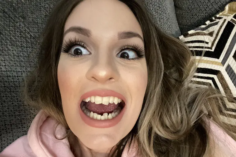 Krivi zubi